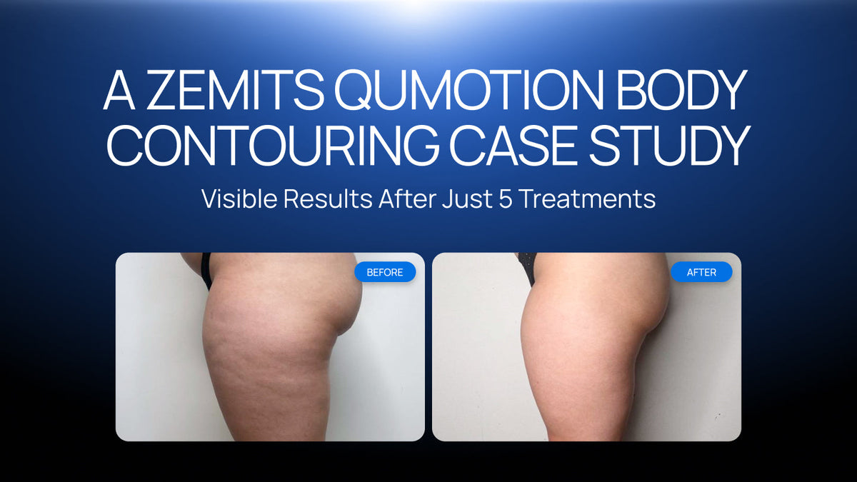 Visible Results After Just 5 Treatments: A Zemits QuMotion Body Contouring Case Study