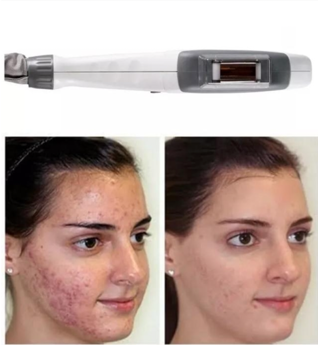 Zemits Light Expert 2.0 Μηχάνημα IPL Λέιζερ