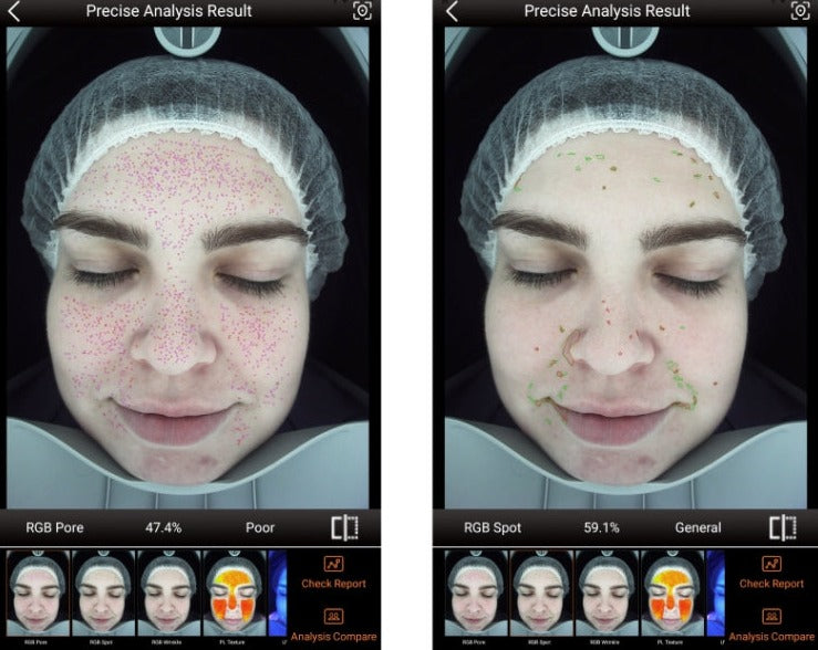 Zemits VeraFace Σύστημα Ανάλυσης Δέρματος