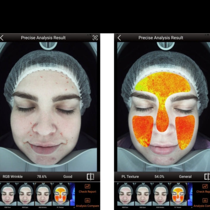 Zemits VeraFace Σύστημα Ανάλυσης Δέρματος