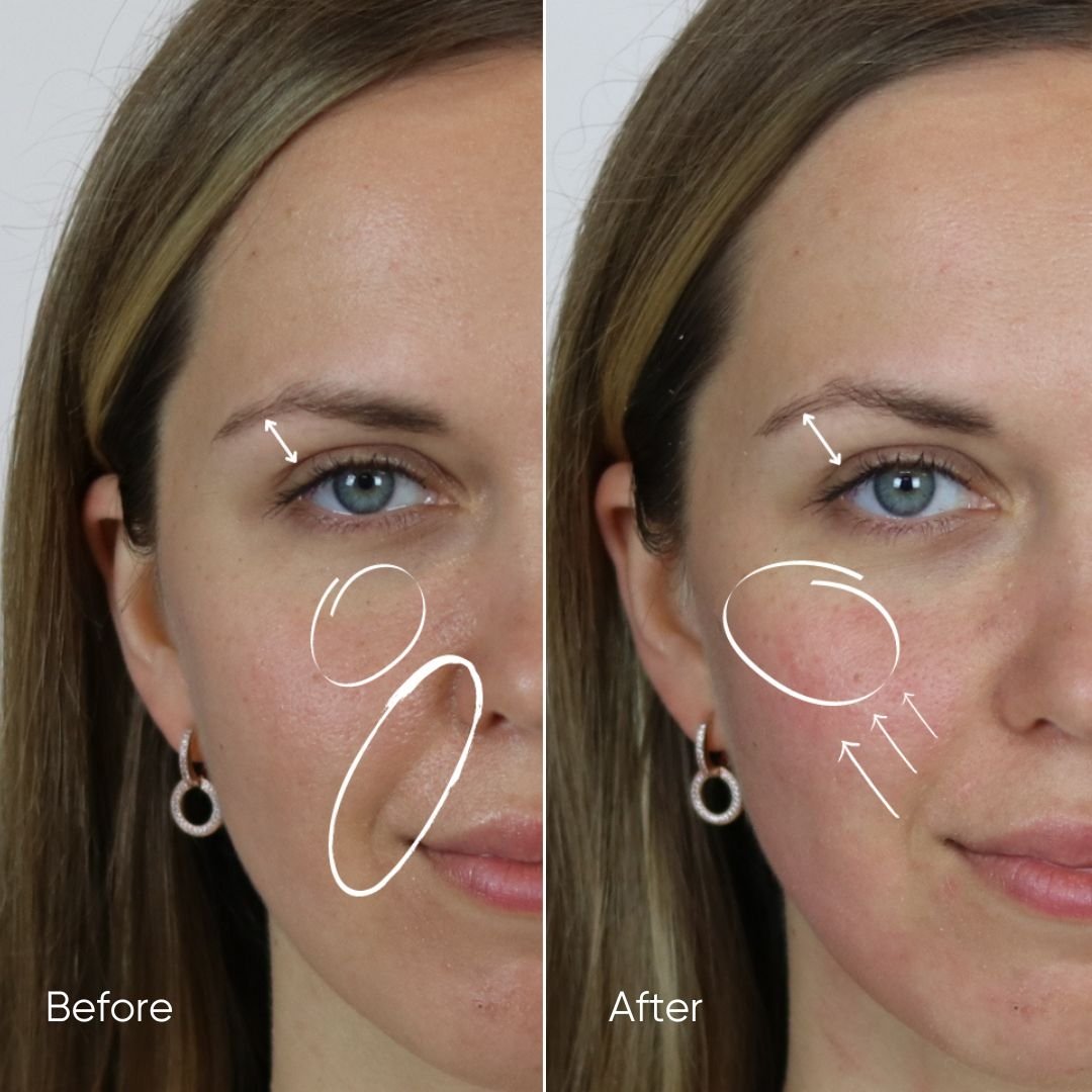 Zemits HydroVerstand PRO 7-σε-1 Σύστημα HydroDiamond™