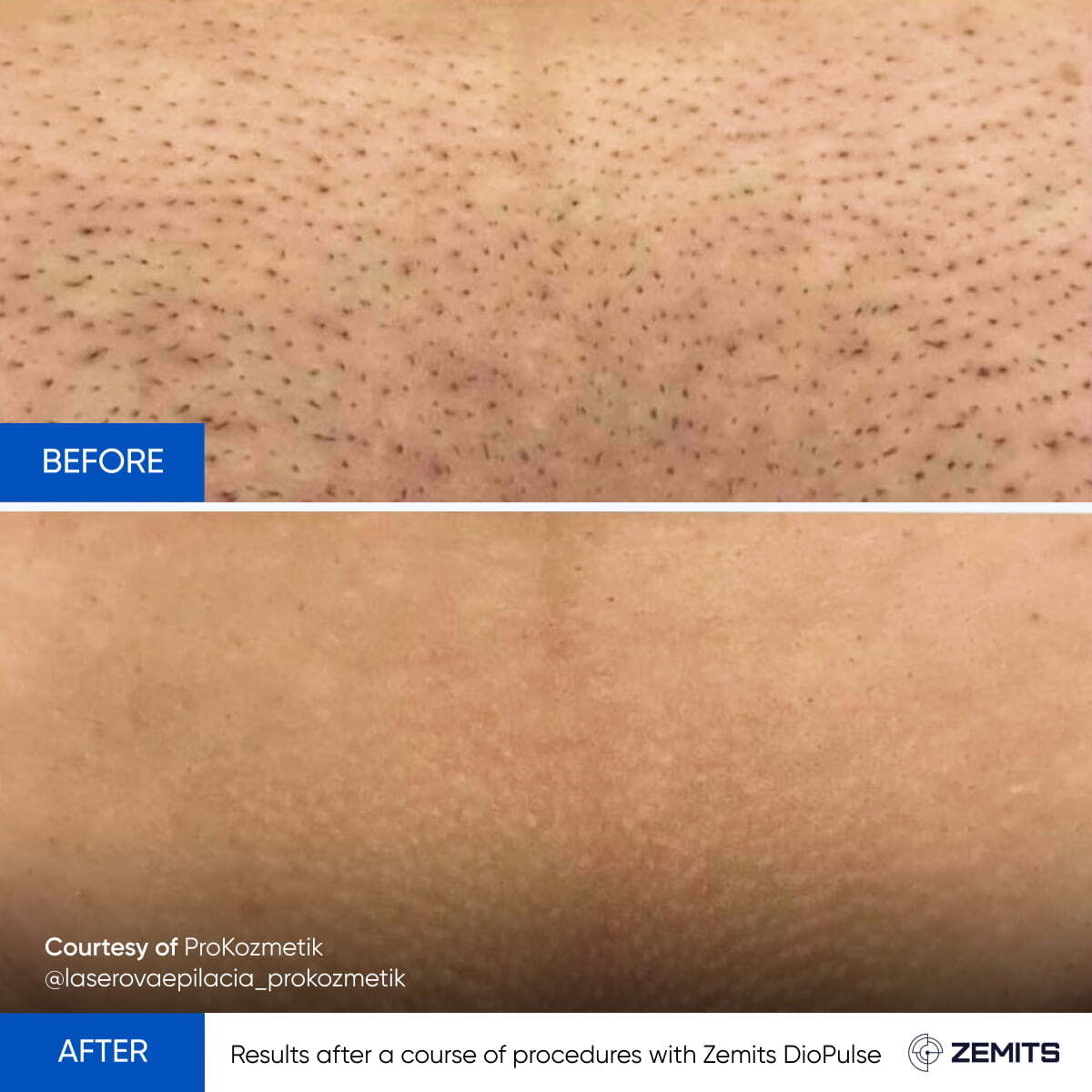 Before After Slide 1